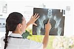 Rear view of a female doctor examining xray in the medical office