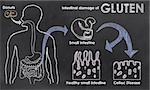 Intestinal Damage of Gluten on a Blackboard