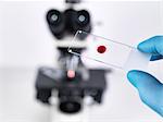 Laboratory scientist holding a slide containing a blood sample with a upright compound microscope in the background