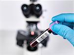 Laboratory scientist holding a blood sample with a upright compound microscope in the background