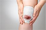 Injured painful knee with bloody gauze bandage