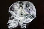 X-ray of skull with cogs as brain, digital montage