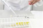 Female hand pipetting yellow liquid into test tubes in lab