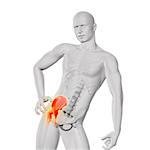 3D render of a male medical figure holding hip in pain