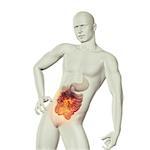 3D render of a male medical figure with fire effect in stomach with exposed guts