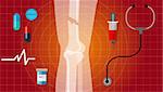 bone fracture broken legs human anatomy x ray medical treatment illustration icon vector
