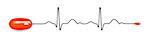 An image of an electrocardiogram with a computer mouse