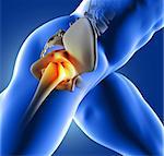 3D render of a blue medical image of close up of hip joint
