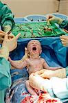 Baby being born via cesarian section operation