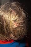 Boy with chewing gum stuck in hair