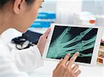 Doctor viewing X-ray of hand on digital tablet