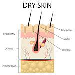 Illustration of The layers of dry skin on the white background. Also available as a Vector in Adobe illustrator EPS 10 format.