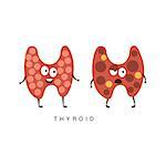 Healthy vs Unhealthy Thyroid Infographic Illustration.Humanized Human Organs Childish Cartoon Characters On White Background