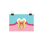 Tooth Anatomy Info Drawing Simple Design Illustration In Cute Fun Cartoon Style Isolated On White Background