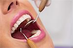 Close up of dentist examining female patient teeth