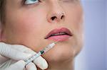 Close-up of female patient receiving a botox injection on lips