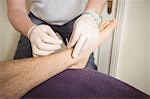 Physiotherapist performing dry needling on the leg of a patient