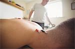 Patient getting electro dry needling on his back of neck