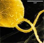 Scanning electron micrograph of algae