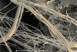 Scanning Electron micrograph of  asbestos, 1500x