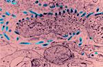 Transmission Electron micrograph of  Ebola virus