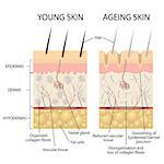 Young healthy skin and older skin comparison, skin layers and wrinkles diagram. Also available as a Vector in Adobe illustrator EPS 10 format.