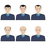 Hair loss stages and types of baldness illustrated on a male head. Also available as a Vector in Adobe illustrator EPS 10 format.