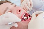 Dentists working on patients teeth