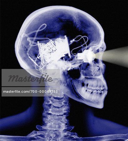 X-Ray of Skeleton with Electronic Eye and Brain