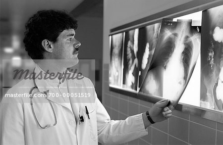 Doctor Examining X-Rays