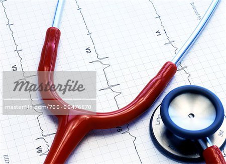 Stethoscope and Electrocardiogram Printout