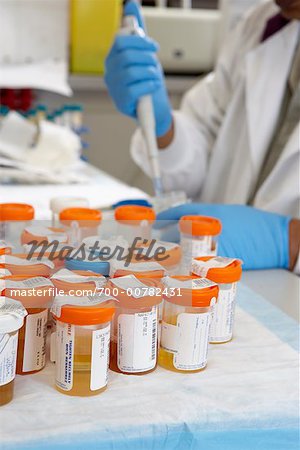 Lab Technician Working with Urine Samples