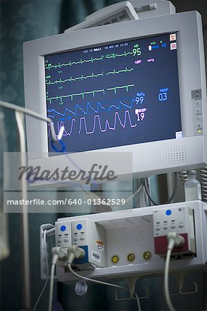 Close-up of vital signs on a computer screen