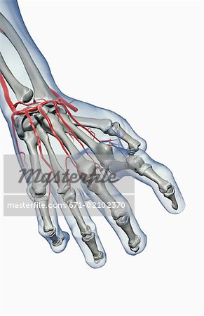 Arthritic Hand