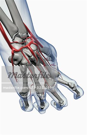 Arthritischen Hand