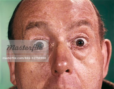 1960s CLOSE-UP DETAIL OF FLORID MAN FACE WITH EYES OPEN WIDE AND STARING