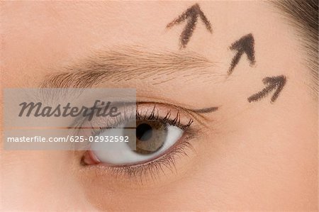 Close-up of a young woman with pre-surgical markings on her face