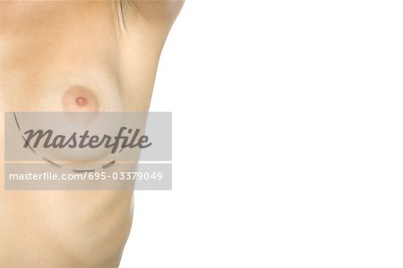 Femme avec des marques de la chirurgie plastique sous la poitrine, recadrée vue