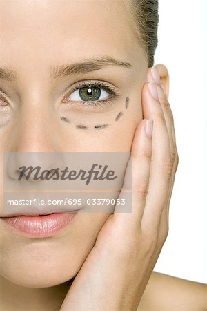 Frau mit plastischen Chirurgie Markierungen unter Auge, Gesicht, halten, Blick in die Kamera zugeschnitten