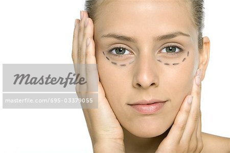 Woman with plastic surgery markings under eyes, holding face, looking at camera