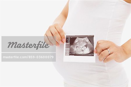 Femme enceinte montrant son échographie