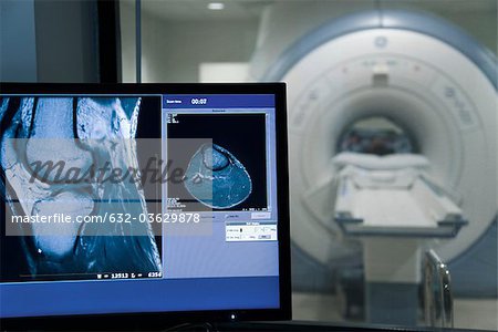 MRI scan result on computer monitor
