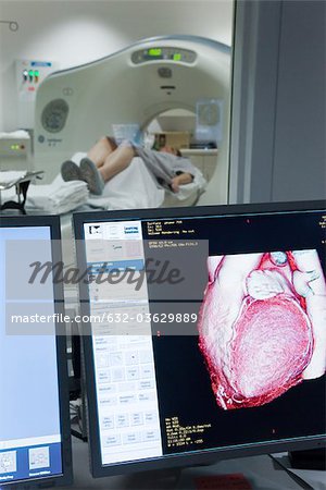 Patient's heart CAT scan result shown on monitor