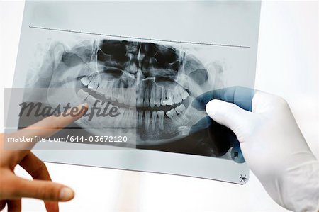 Dental panoramic xray