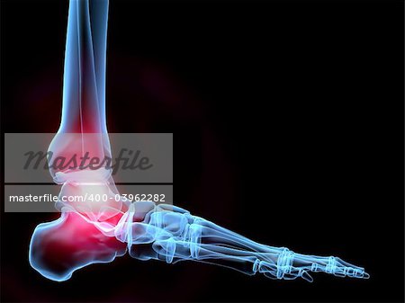 3d rendered x-ray illustration of a human foot with pain