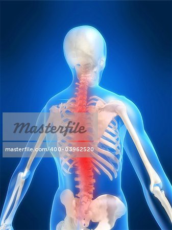 3d rendered anatomy illustration of a human skeleton with a painful spine