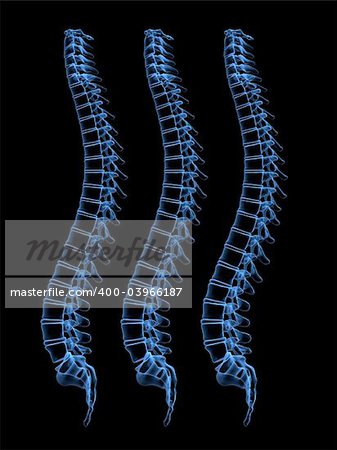 3d x-ray illustration of three human spines