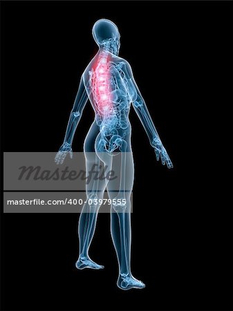 3d rendered anatomy illustration of a female skeleton with painful spine