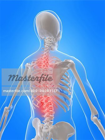 3d rendered x-ray illustration of a human skeletal back with a painful spine