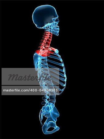 3d rendered x-ray illustration of a human torso with a painful neck